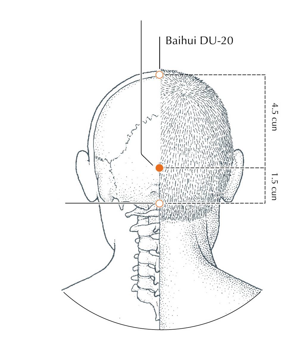 <p>DU-17</p>