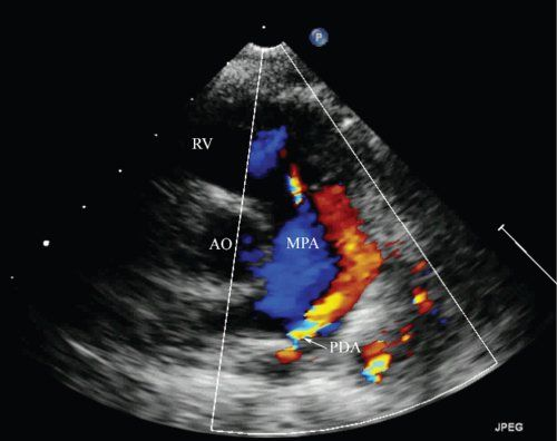 <p>What is seen in this 2D image?</p>