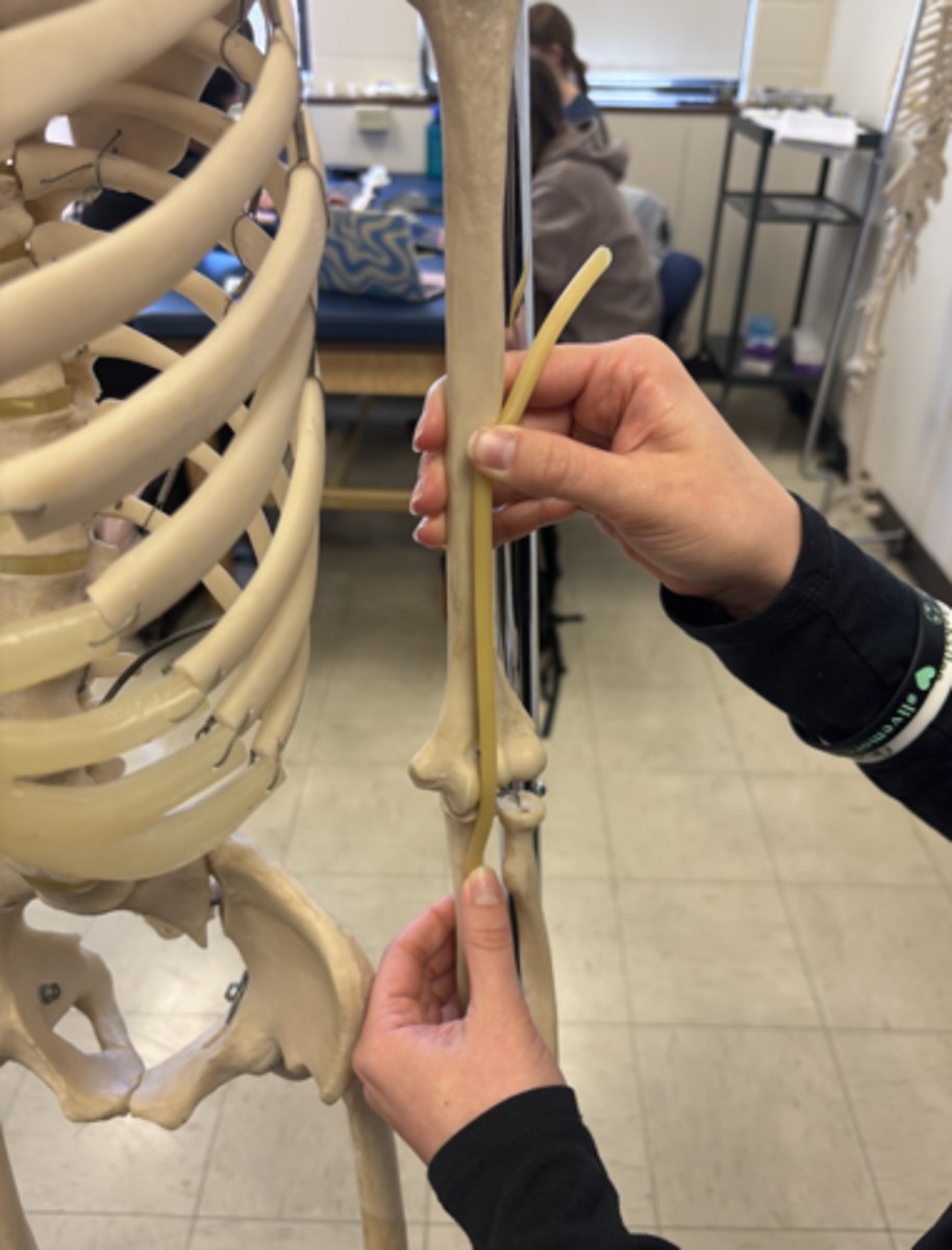 <p>What is this muscle?</p>