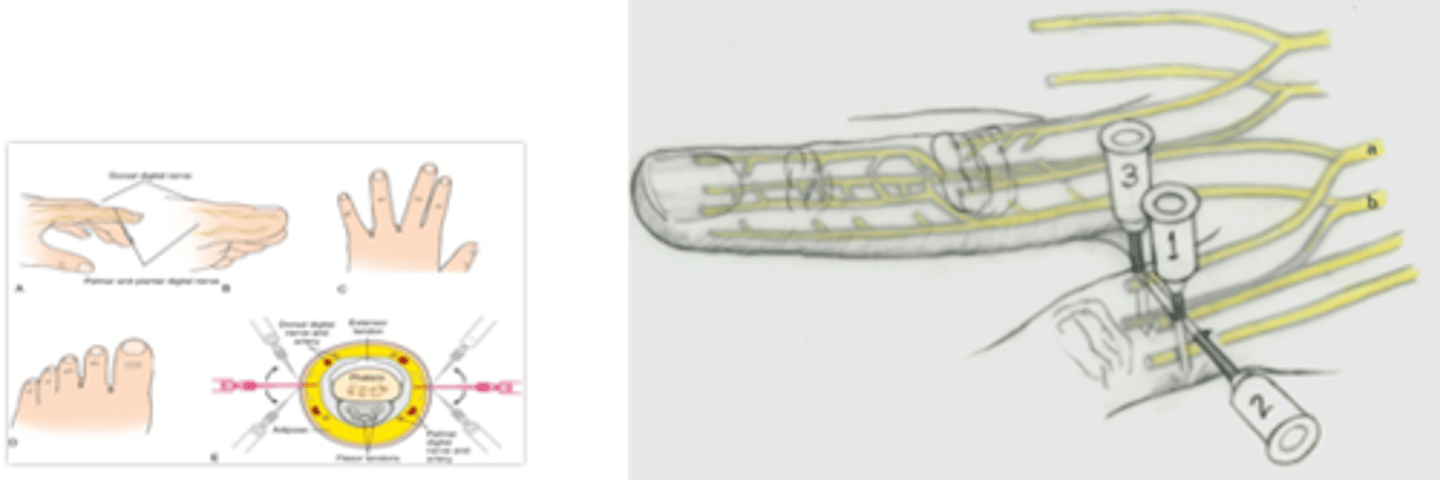 <p>Distal to webspace</p>