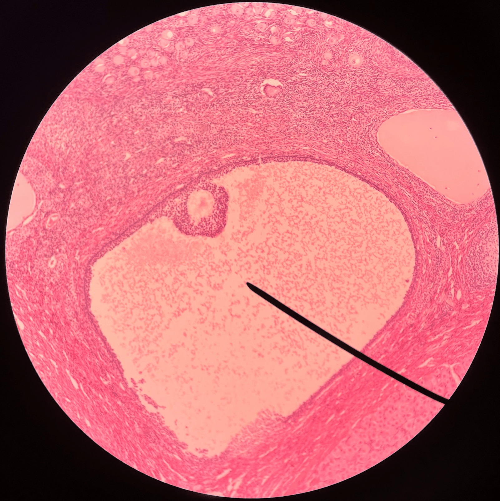 • Slide histology of the ovary.

• The large fluid-filled central cavity of a Graafian follicle.