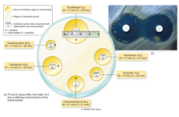 <p>What technique is shown in the image?</p>