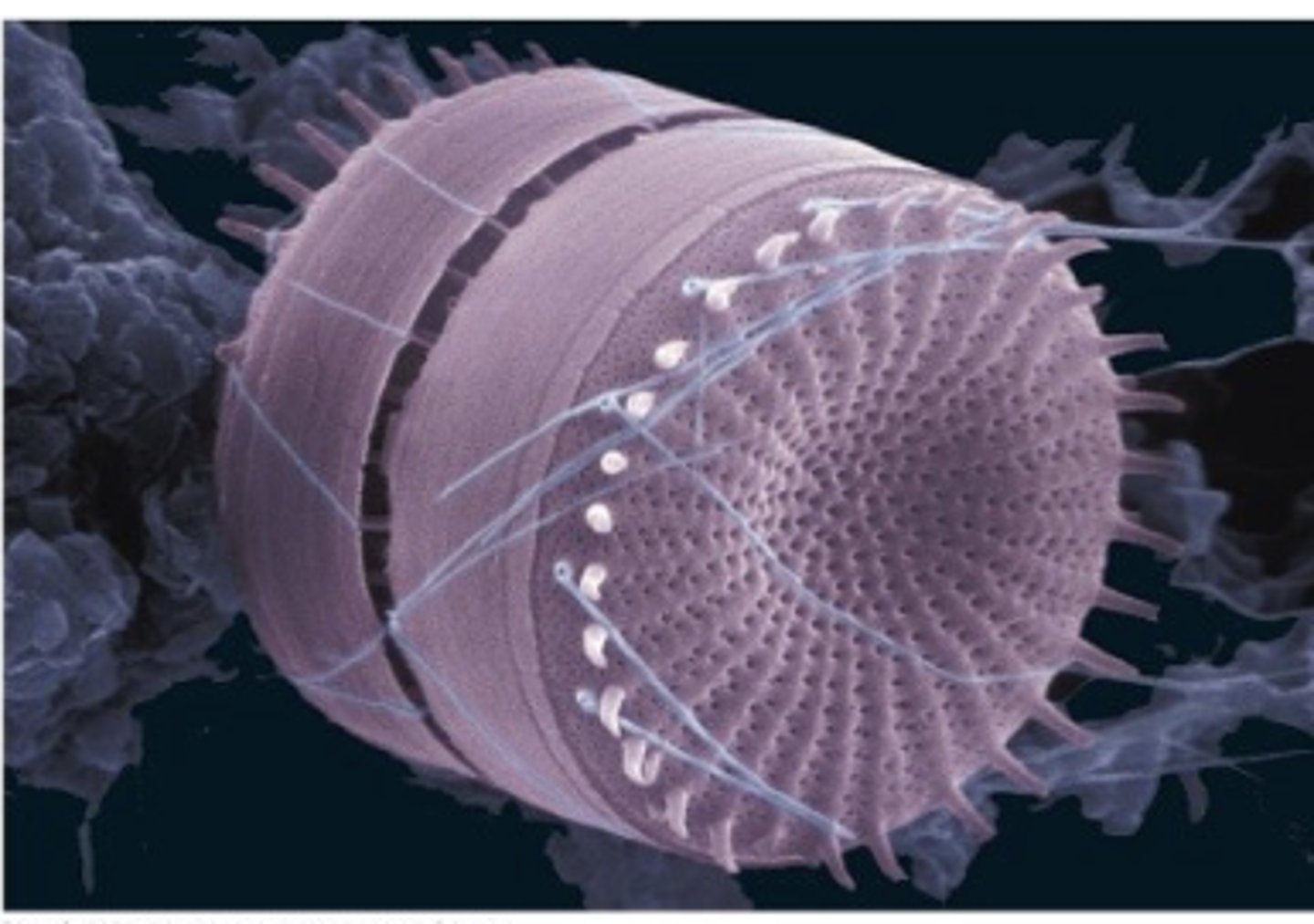 <p>orgamisms like the one on the right have a cell wall comprise off ?</p>