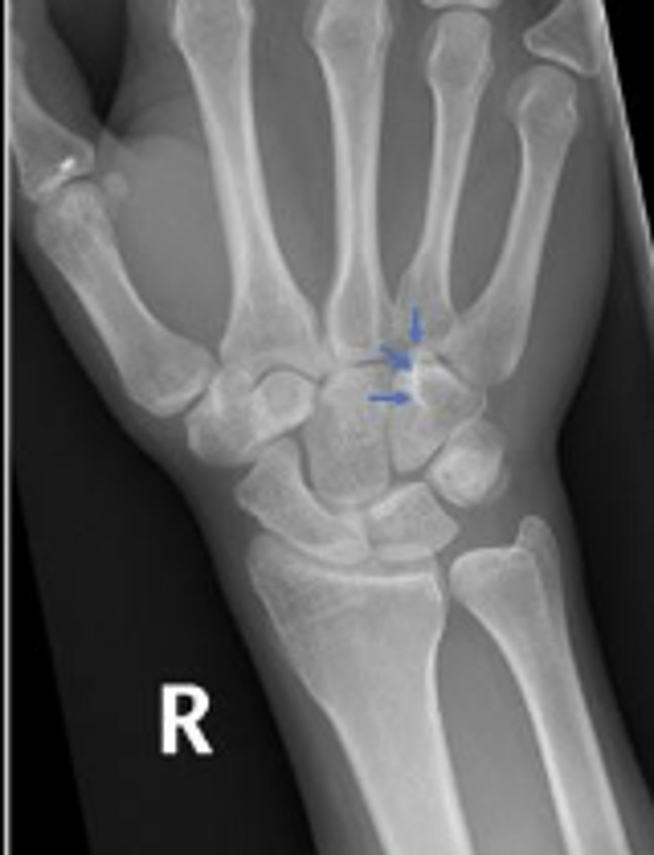 <p>What are the arrows pointing to?</p>