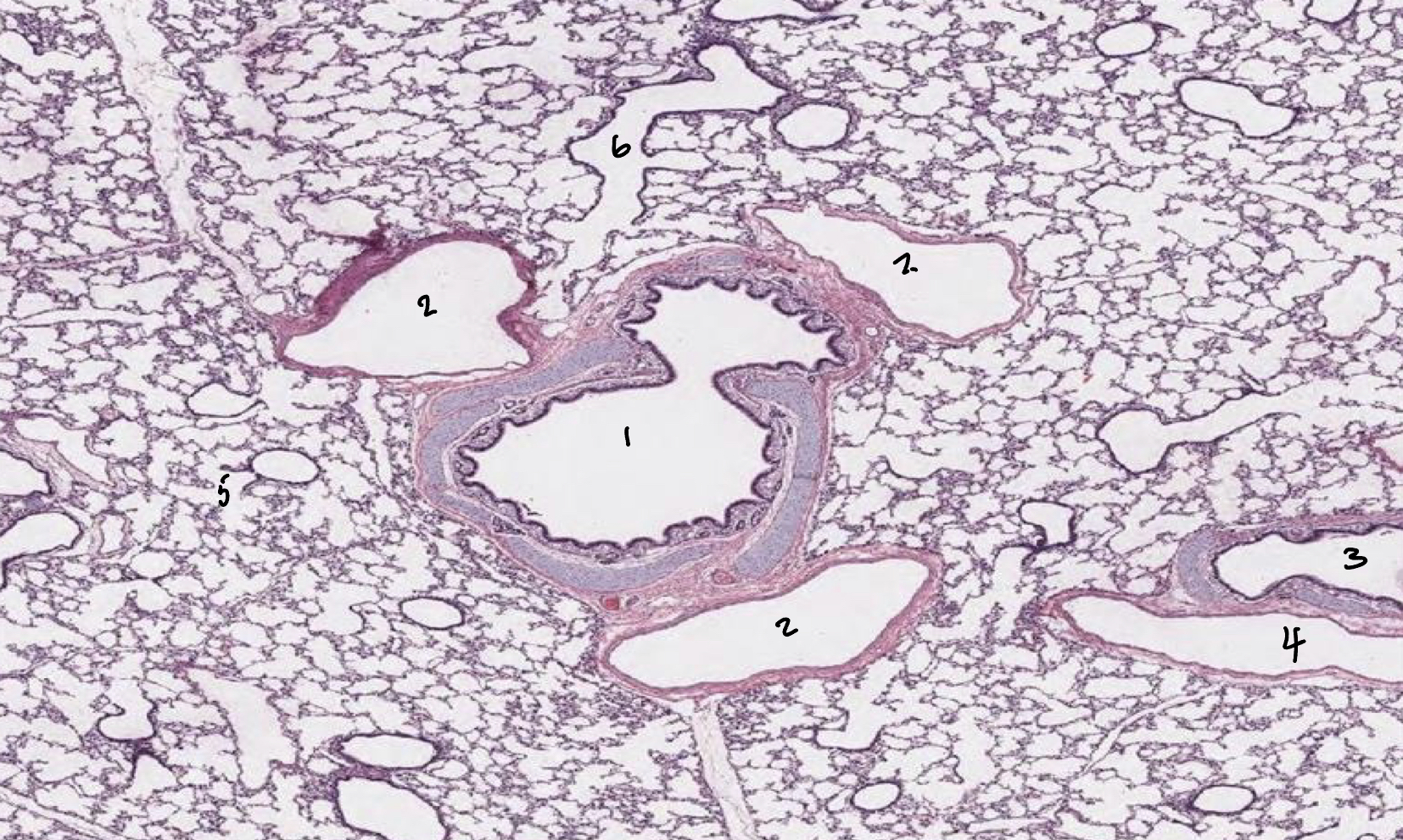 <p><span style="color: blue"><strong><mark data-color="blue" style="background-color: blue; color: inherit">Lungs:</mark></strong></span><strong> Label </strong>1-6</p>