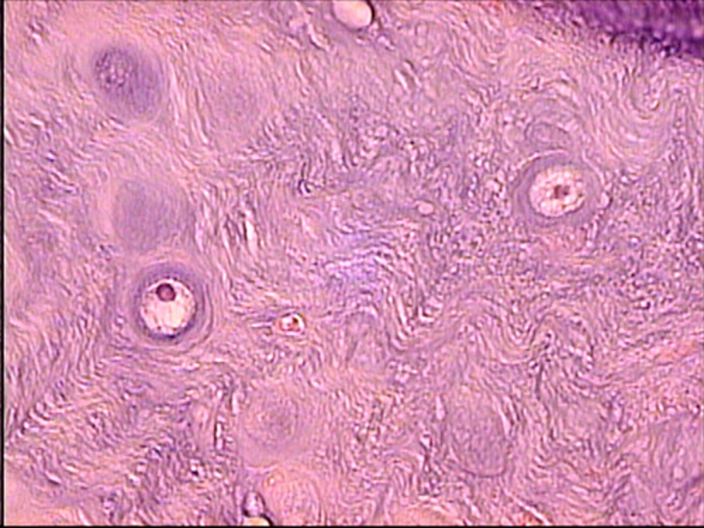 <p>cell has collagenous fibers (tougher/stronger)</p><p>found in intervertebral discs, pubic symphisis (joint btwn left &amp; rt pubices)</p>