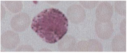 <p>Basophils </p>