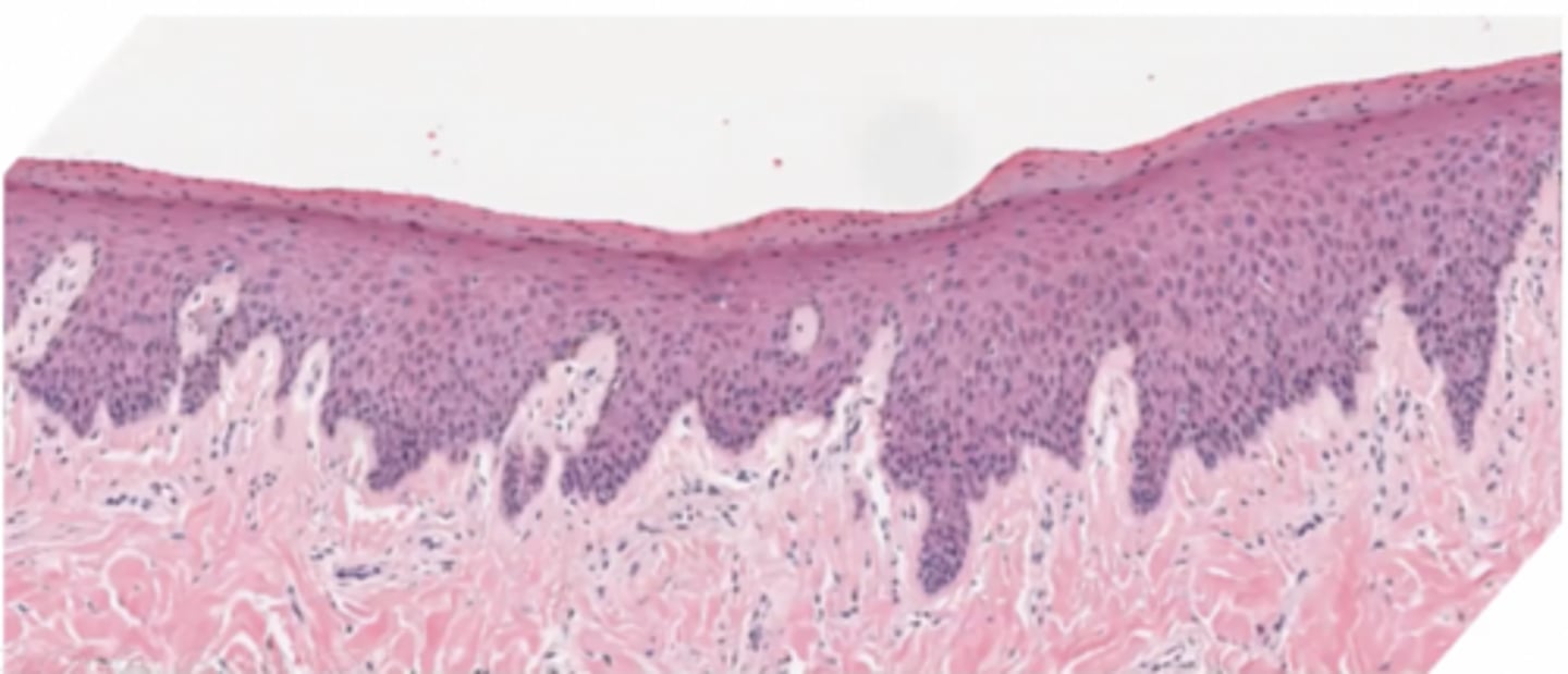 <p>Where might this epithelium be found?</p>