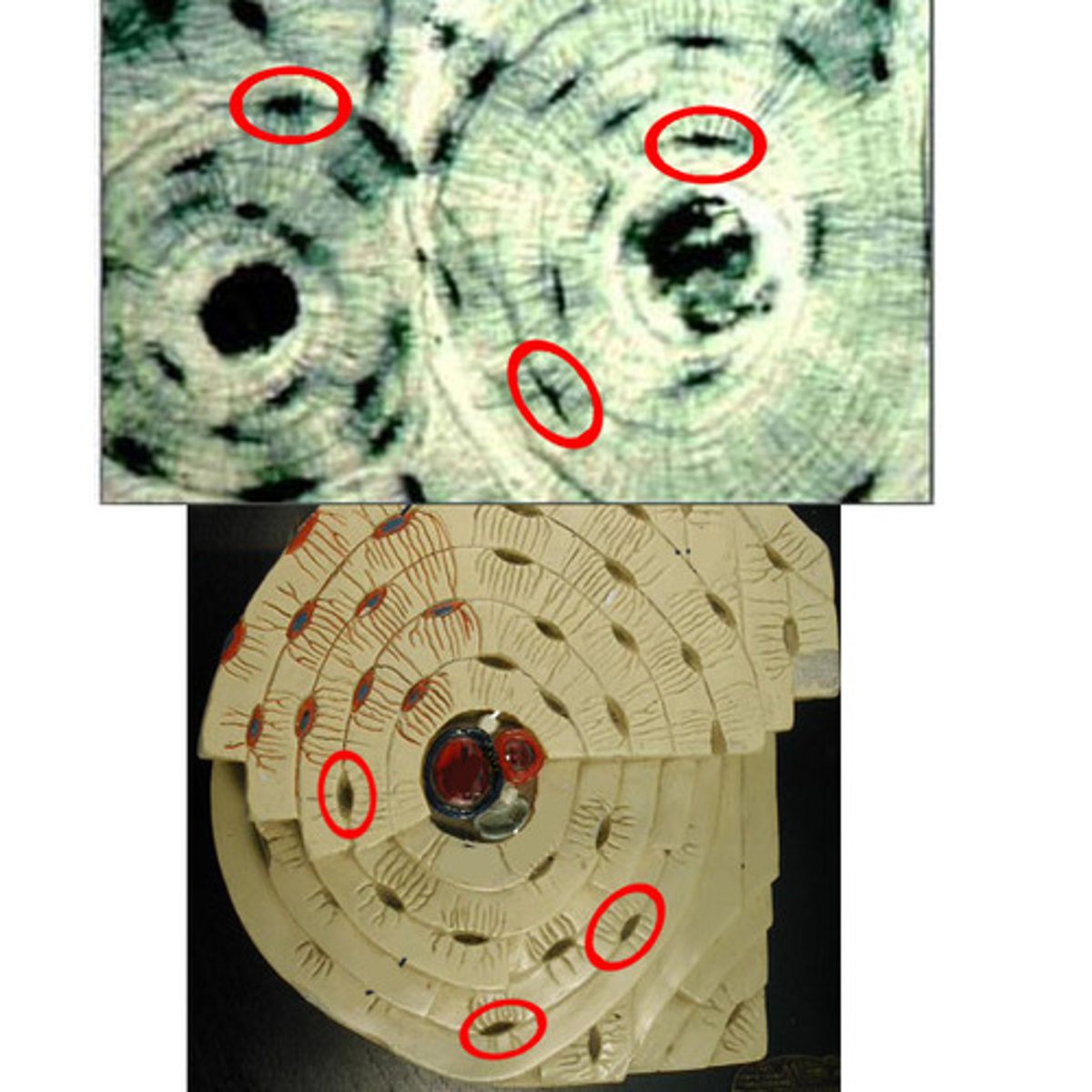 <p>Cavities containing bone cells (osteocytes); arranged in concentric rings</p>
