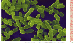 <p>Genus Yersinia</p>