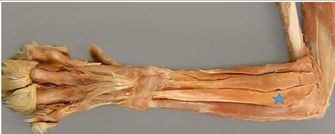 <p>Lateral digital extensor m. (blue star)</p>