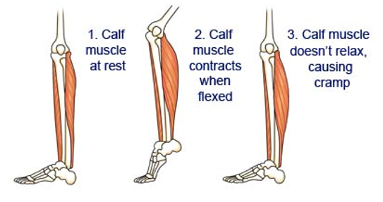 <p>up to a minute</p><p>accumulation of lactate in muscle fibre makes sarcoplasm more acidic → enzymes stop functioning</p><p>fermentation longer than 2-3 minutes → cramping, fatigue (lack of ATP therefore muscles cannot relax)</p>