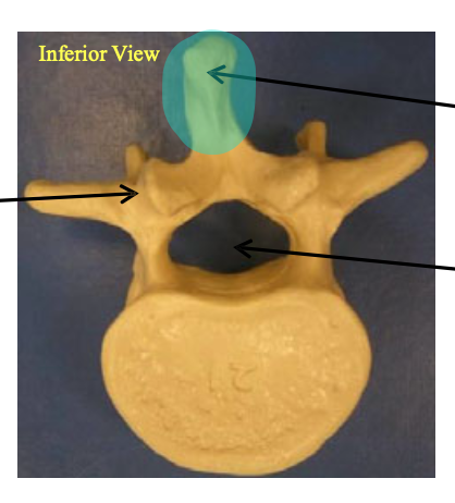 <p>Name the group of vertebrae this one belongs to; then, name the highlighted structure</p>