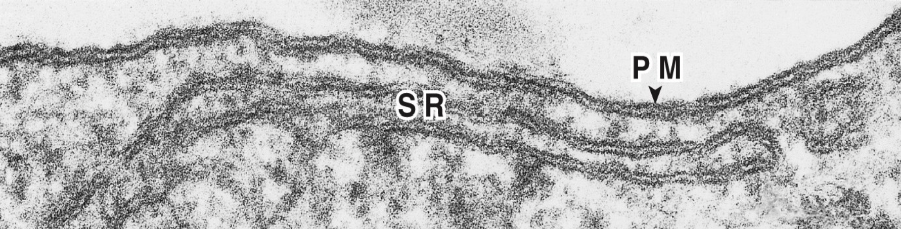 <p>A complex network of specialized smooth endoplasmic reticulum that is important in transmitting the electrical impulse as well as in the storage of calcium ions.</p>