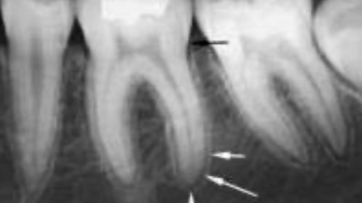 <p>ID the structure:</p>