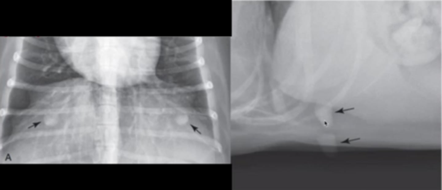 <p>The arrows are pointing to what appears to be a pathology, but what is it really?</p>