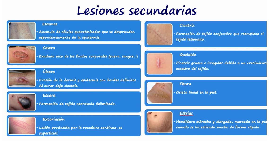 <p>Escara.</p>