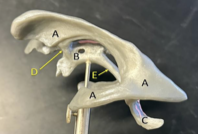 <p>Identify the structure labeled B. </p>