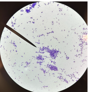 <p>gram positive rods (larger) in chains/pairs:</p>