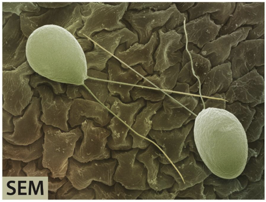 <p>Eukaryal microorganisms: Model organisms</p><ul><li><p>Some algae are single-celled, but many are multicellular.</p></li><li><p>All are <strong><em>photosynthetic</em></strong> with <strong><em>cellulose</em></strong> cell walls.</p></li><li><p>Chlamydomonas has a<strong><em> two-flagella form</em></strong> good for studying eukaryal flagella biogenesis/function.</p></li><li><p>Chlamydomonas is also studied because of its <strong><em>ease of growth and durability.</em></strong></p></li></ul><p></p>