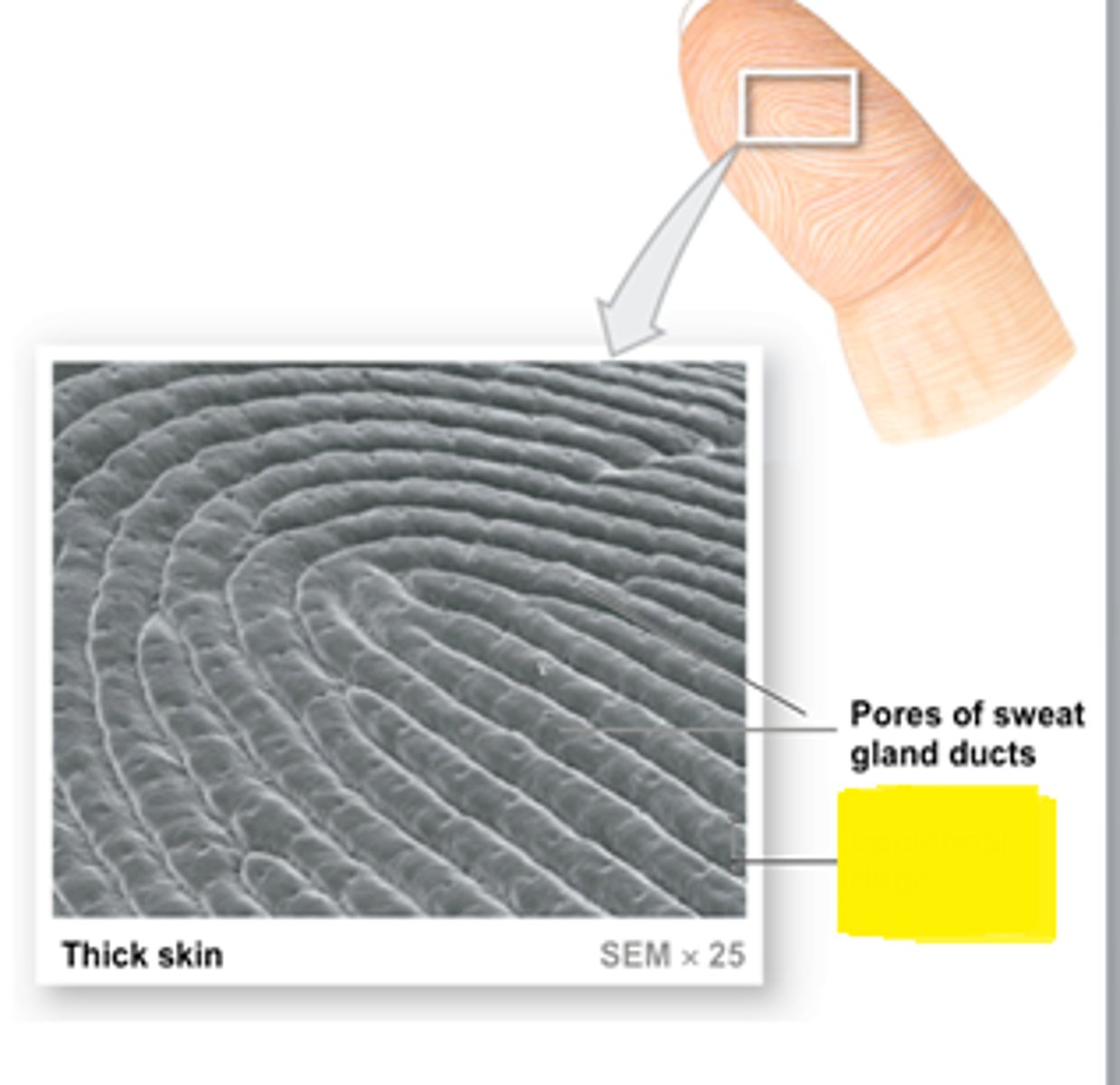 <p>Epidermal Ridge</p>