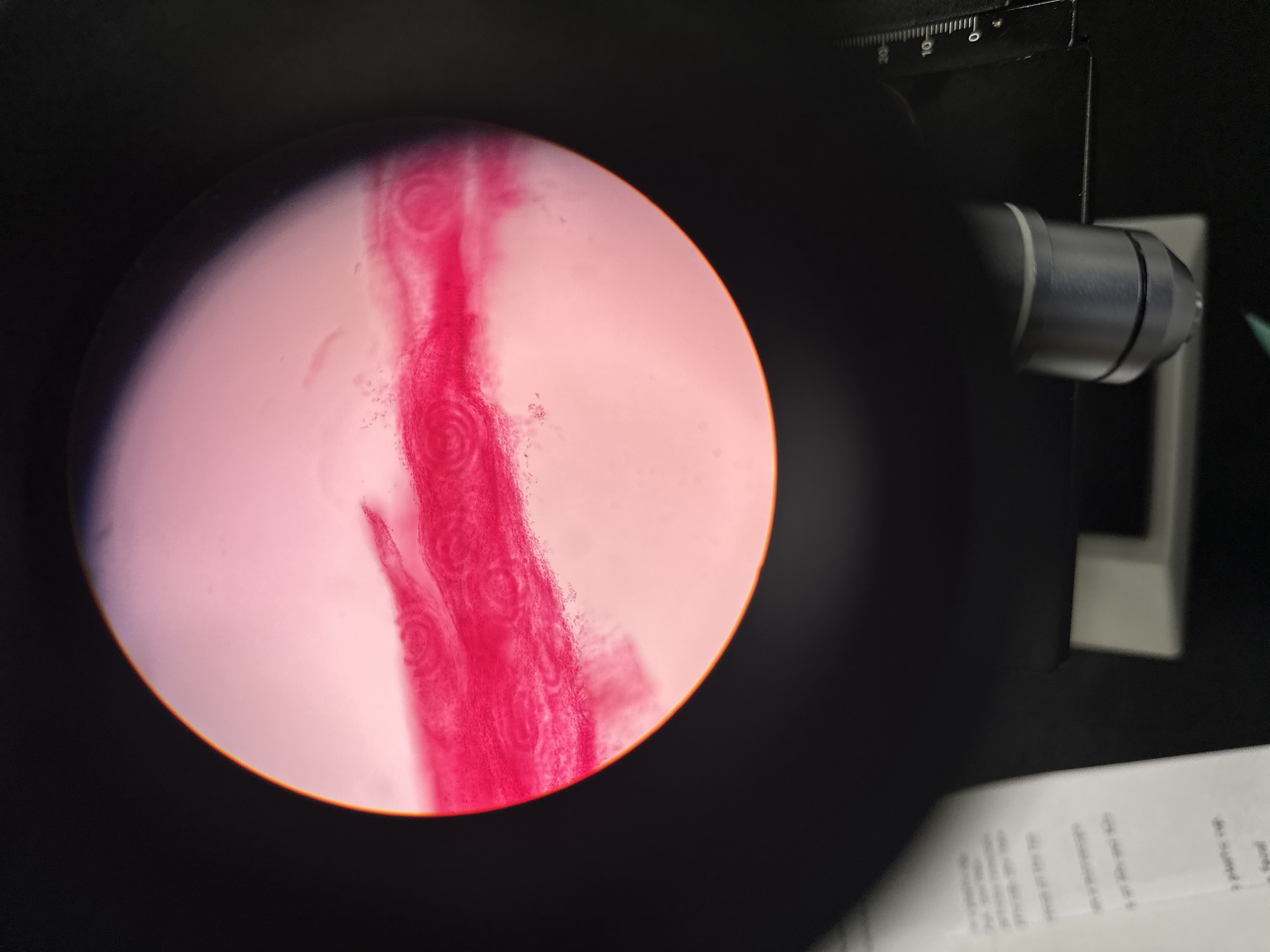 <p>A type of roundworm that can be zoonotic through the consumption of raw meat.</p><p>Pigs, horses, etc.</p>