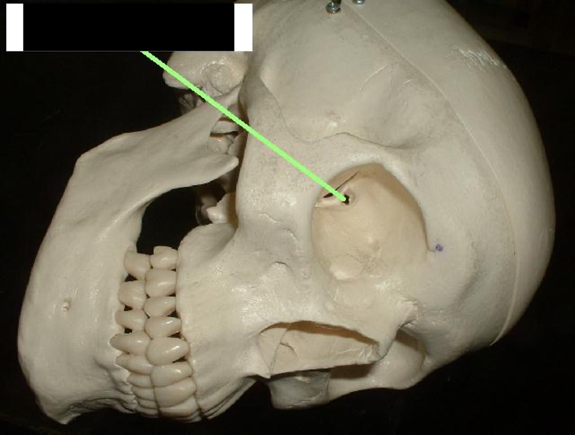 <p>Inside of eye socket (circular) through lesser wings.</p>