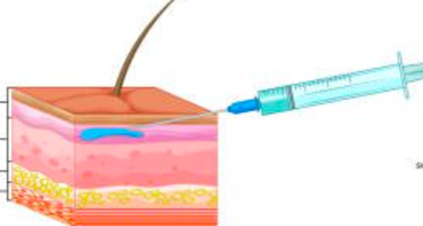 <p>- a parenteral route</p><p>- administered by injecting the drug between the layers of skin​ (second layer of skin)</p><p>- Sites are on the inside of lower arm for TB testing, on upper back for allergy testing</p>