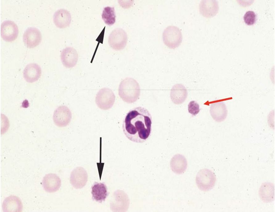 The red arrow refers to a structure that is