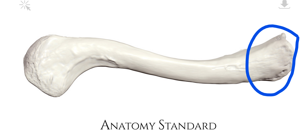 <p>Side of clavicle that articulates with the sternum</p>