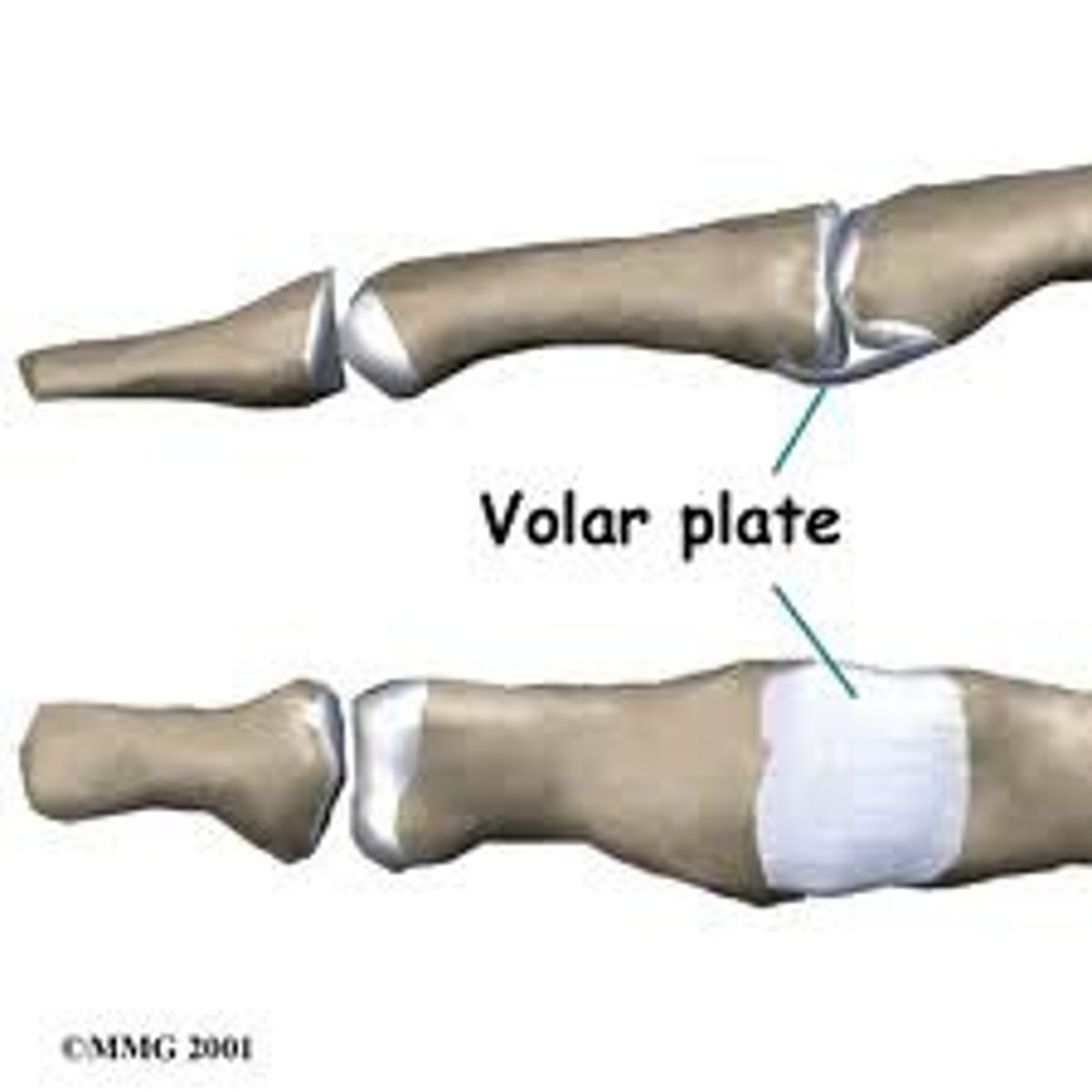 <p>Prevents hyperextension</p>