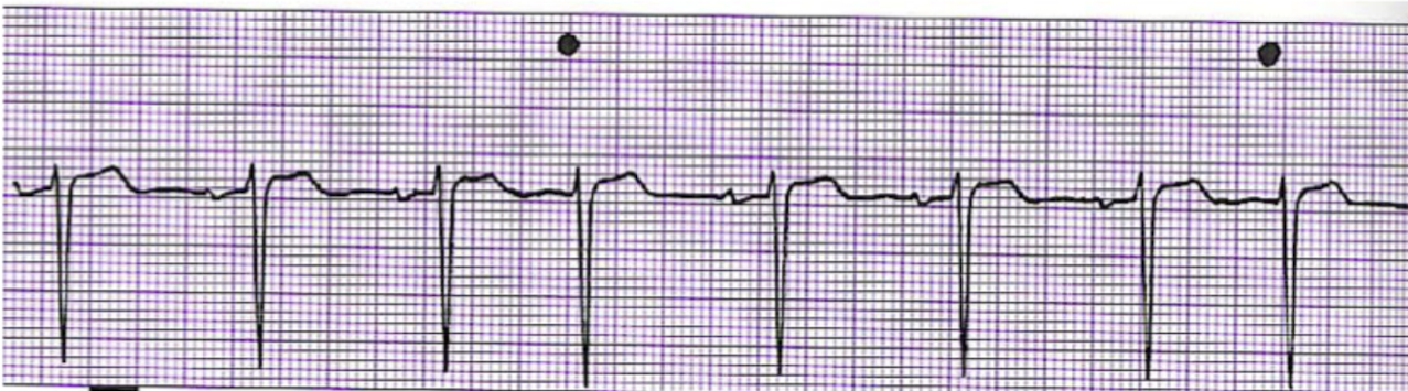 <p>What is this rhythm?</p>
