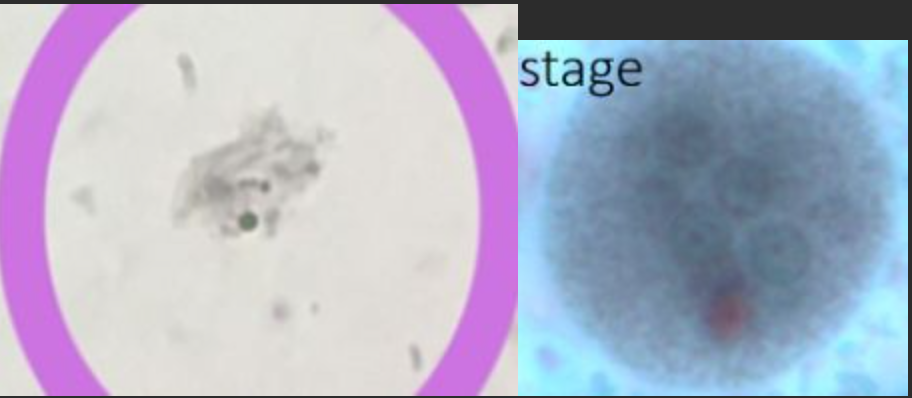 <p>Name & Stage</p>