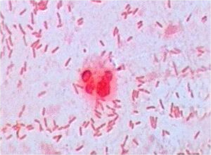 <p>What am i- gram stain, shape, arrangement</p>