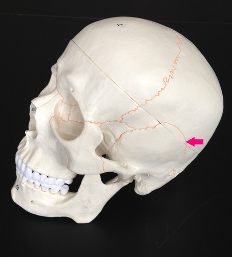 <p>Identify the suture.</p>