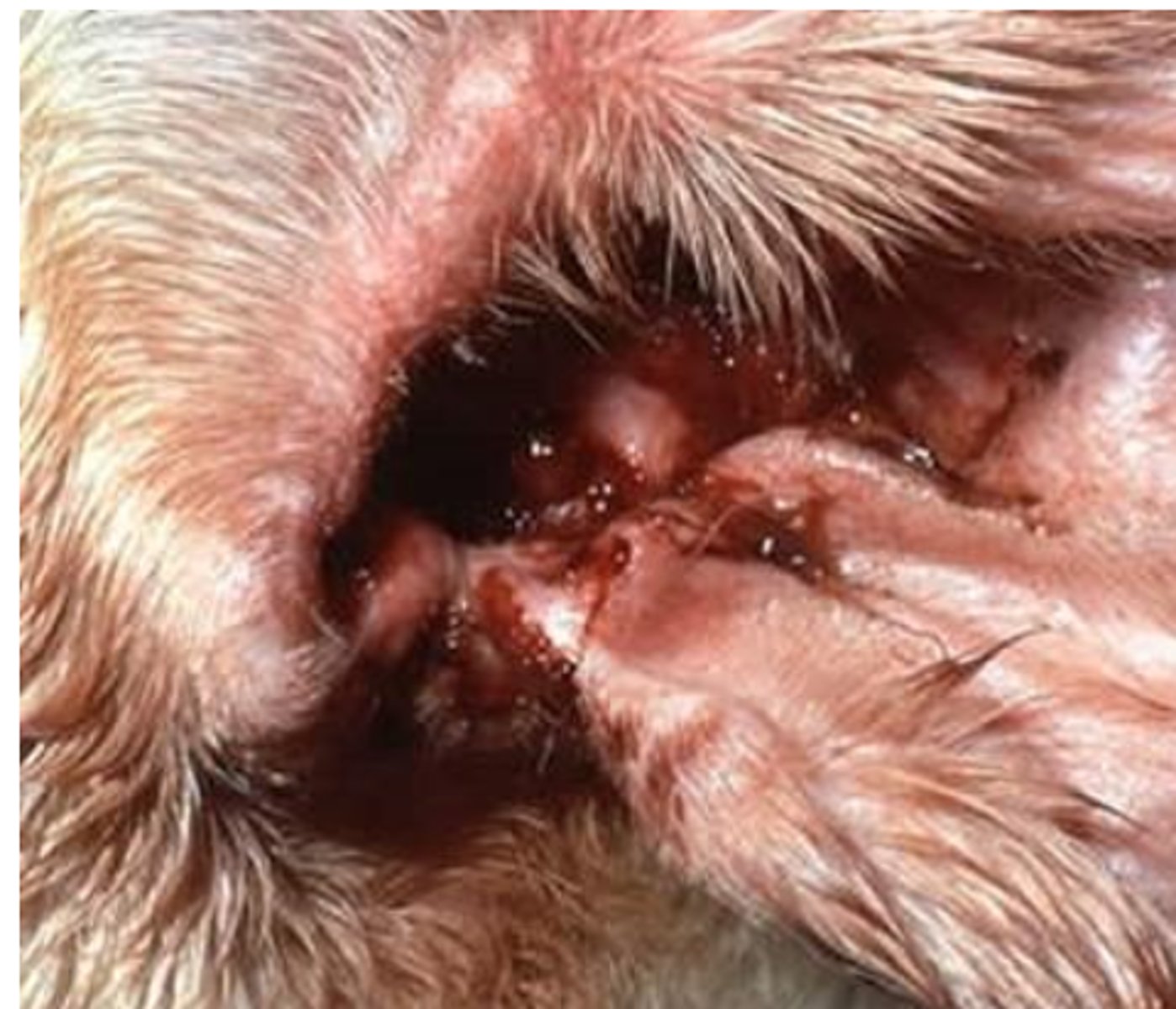 <p>what is this condition called? what yeast species causes it? what sample would we take?</p>