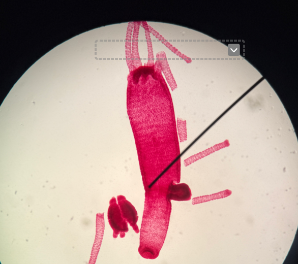 <p>Animalia &gt; Cnidarian &gt; Hydrozoa &gt; Hydra</p><p><span>Hydra (cnidarian):</span></p><p>-Polyp (tubular body with&nbsp;<strong>tentacles</strong>,&nbsp;<strong>mouth</strong>&nbsp;at top center,&nbsp;<strong>bud</strong>&nbsp;is the little arm growing on the side, &nbsp;<strong>stalk</strong>&nbsp;elongated central body, and&nbsp;<strong>foot</strong>&nbsp;is bottom center to help anchor itself)</p><p>Only cnidarian with JUST POLYP</p>
