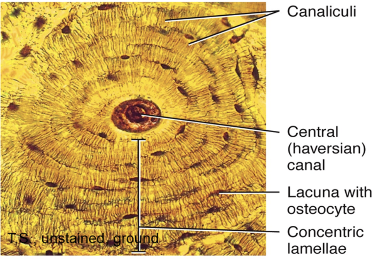 <p>osteons with Haversian canal, concentric lamellae, lacunae with osteocytes (elongated brown specks arranged in concentric layers around Haversian canals), canaliculi visible as fine lines, periosteum, Haversian systems visible in transverse sections, interstitial systems</p>