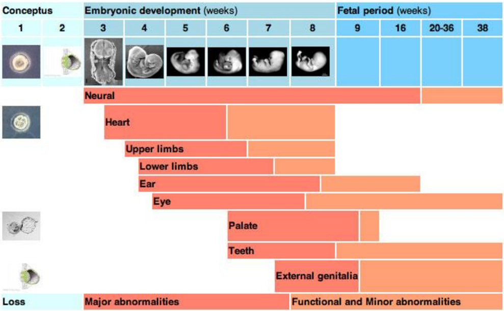 <p>factors include: teratogens, envi, genetic, mechanical.</p><p>the longer the time of dev the higher the chance of being affected</p>