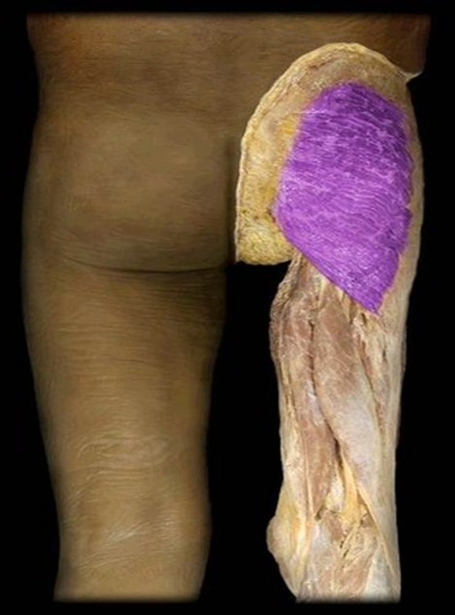 <p>What is the name of this muscle, highlighted in purple?</p>