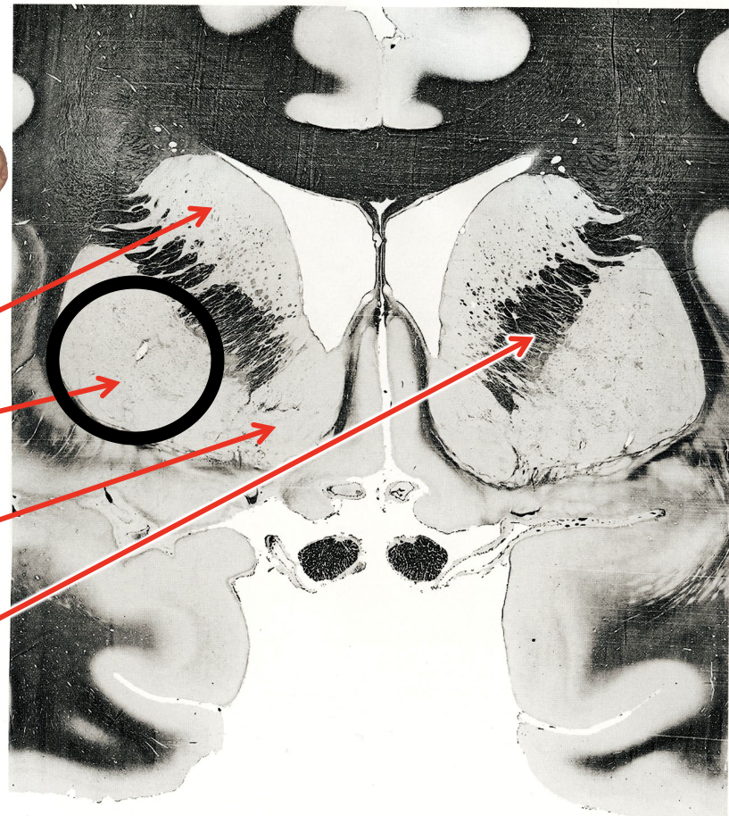 <p>what is the circled region?</p>
