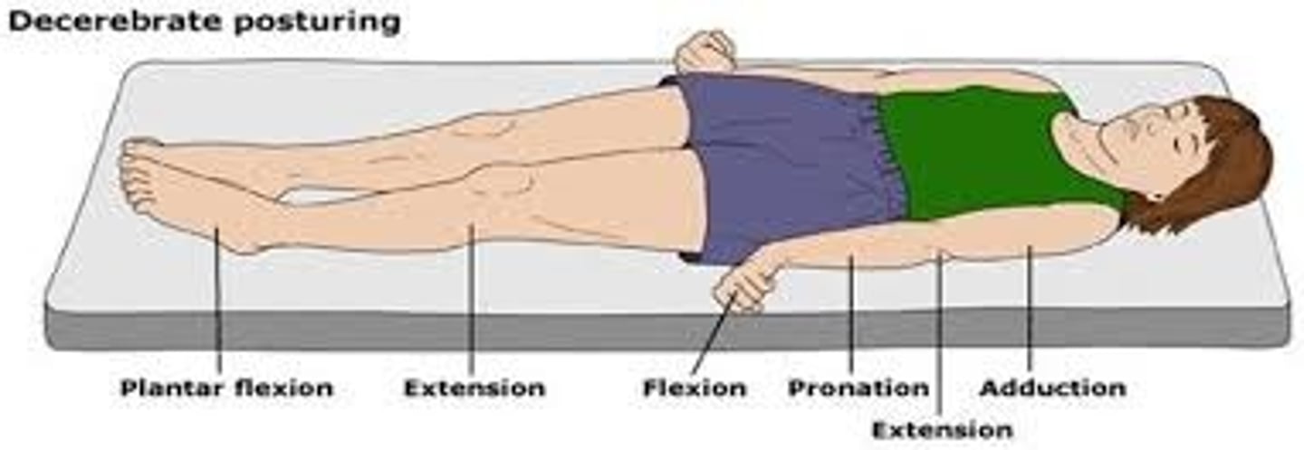 <p>abnormal body posture that involves the arms and legs being held straight out, the toes being pointed downward, and the head and neck being arched backward,</p>