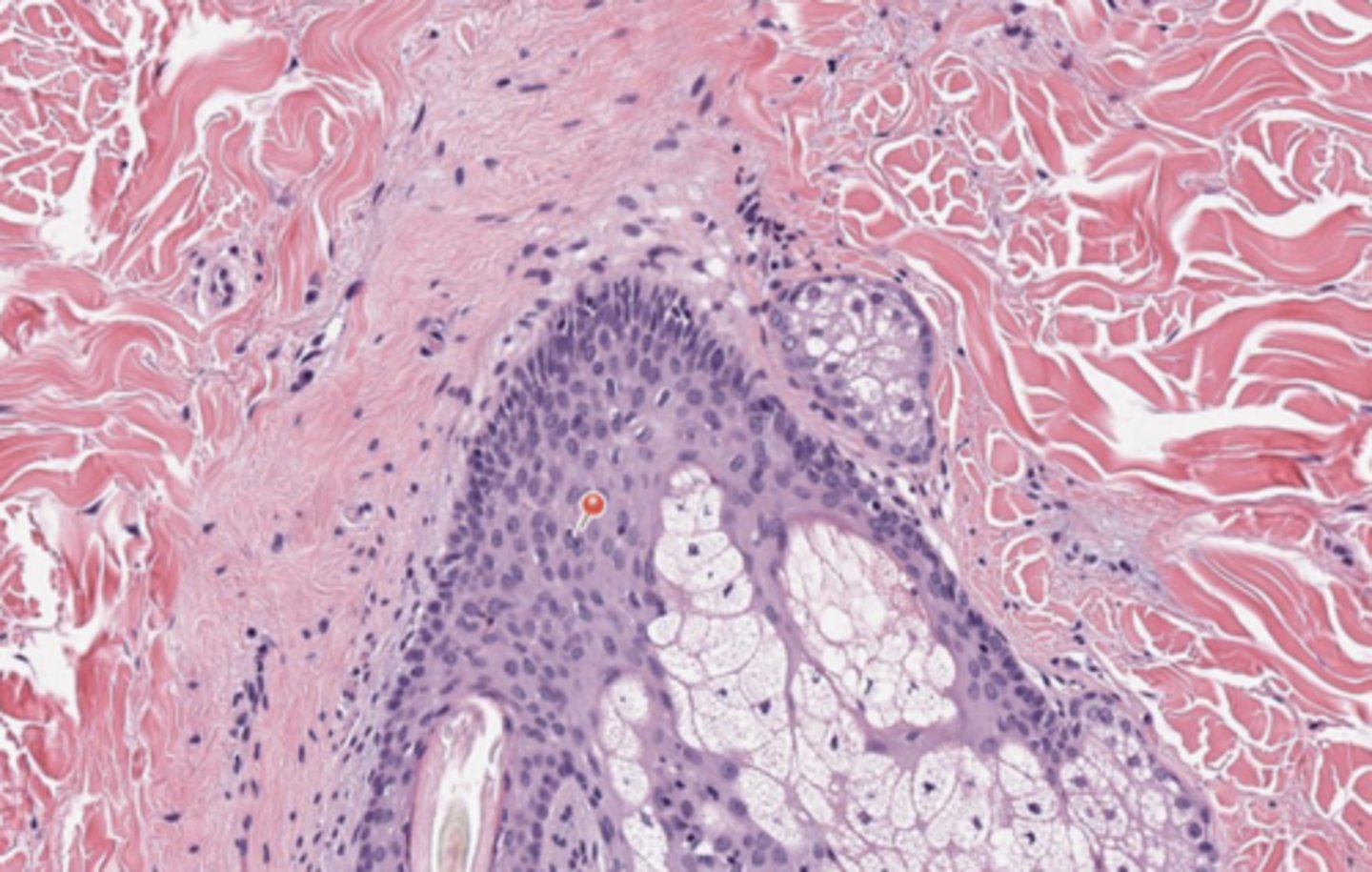 <p>Skin</p>