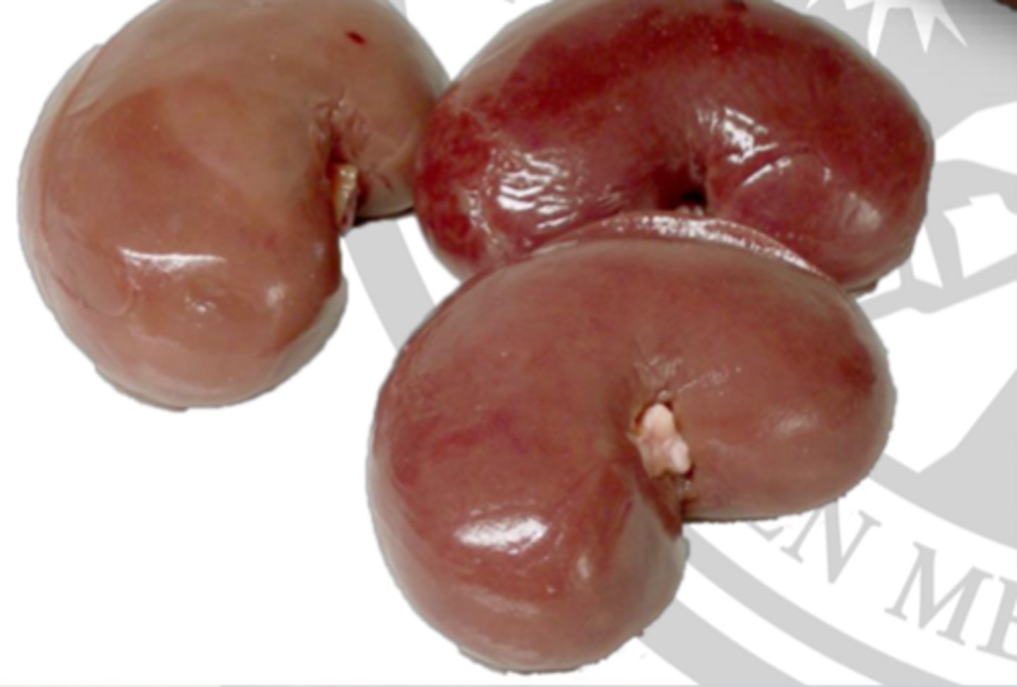 <p>describe the shape of the small ruminant kidney</p>