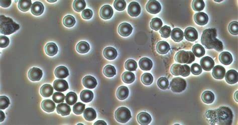 Phase contrast microscopy