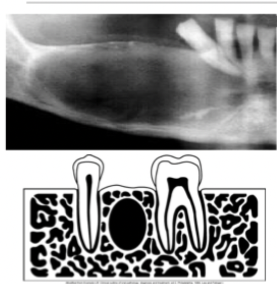 <p>An area without teeth</p>