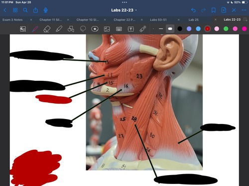 <p>What muscle is this?</p>