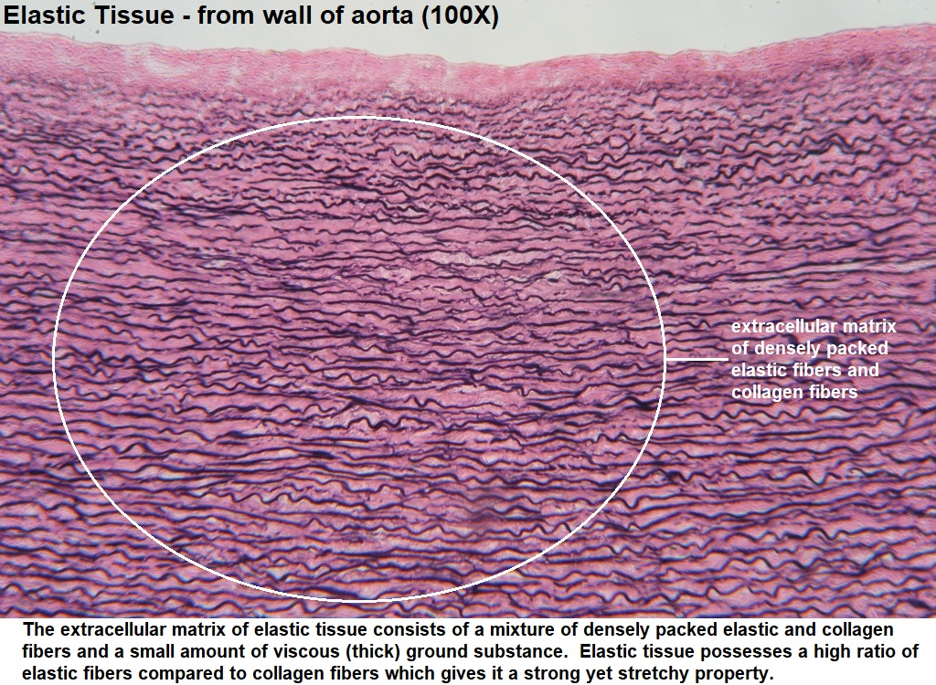 <p>stretchy and squiggly appearance; densely packed fibers</p><ul><li><p>allows <strong>recoil of tissue following stretching</strong>; maintains pulsatile flow of blood through arteries; aids passive recoil of lungs</p></li><li><p>located in walls of <strong>large arteries</strong>; within certain ligaments associated with vertebral column, within the walls of the bronchial tubes</p></li></ul><p></p>