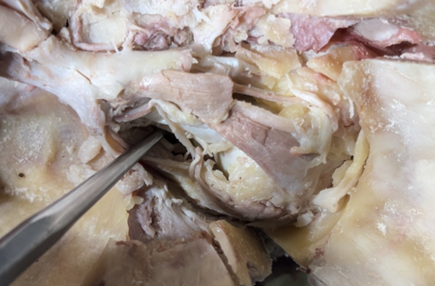 <p>The muscle running under the eye is the</p>