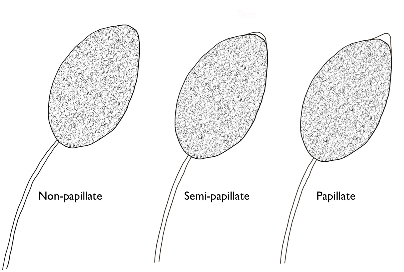 <p>site of zoospore discharge (plural)</p>